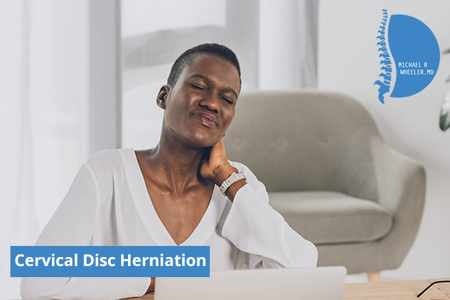 Dallas Cervical Disc Herniation